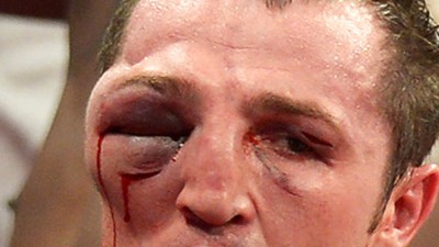 САМЫЕ ЖУТКИЕ ТРАВМЫ В БОЯХ. СЛАБОНЕРВНЫМ НЕ СМОТРЕТЬ. ВИДЕО.