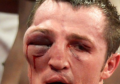 САМЫЕ ЖУТКИЕ ТРАВМЫ В БОЯХ. СЛАБОНЕРВНЫМ НЕ СМОТРЕТЬ. ВИДЕО.