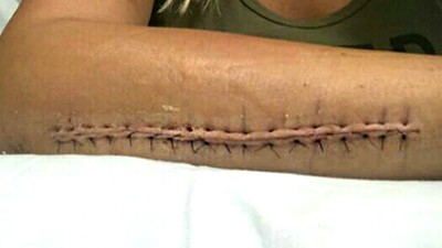 Киборг Ванзант 