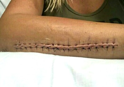 Киборг Ванзант 