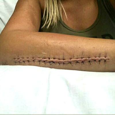 Киборг Ванзант 